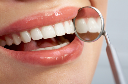 Frequently Asked Questions About Dental Veneers